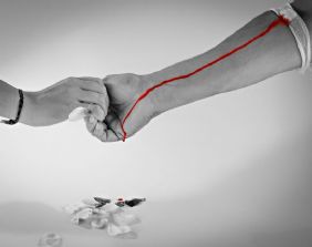 Le Sezioni Unite sui danni subiti per effetto della trasfusione di sangue